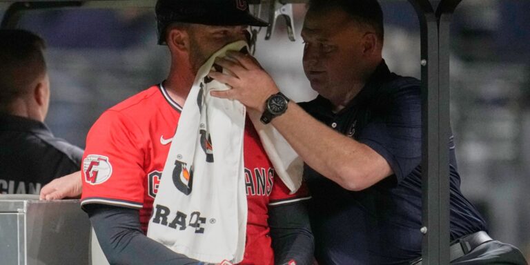 noticia-mlb-Fry-fracturas-faciales-y-nasales-evitara-cirugia